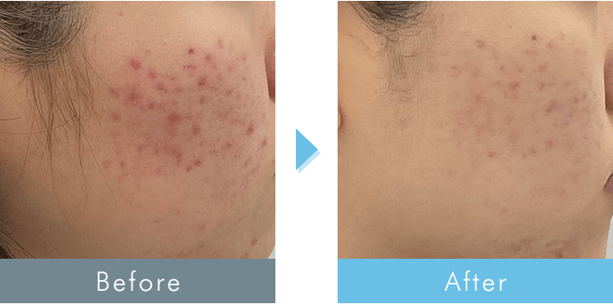 before after