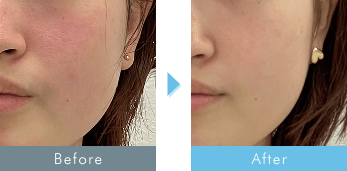 before after
