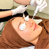 レーザートーニング