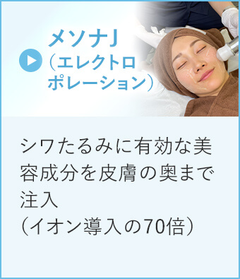 エレクトロポレーション