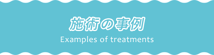施術の事例